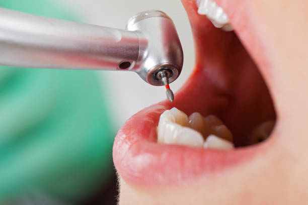Best Pediatric Emergency Dentist in Stallings, NC